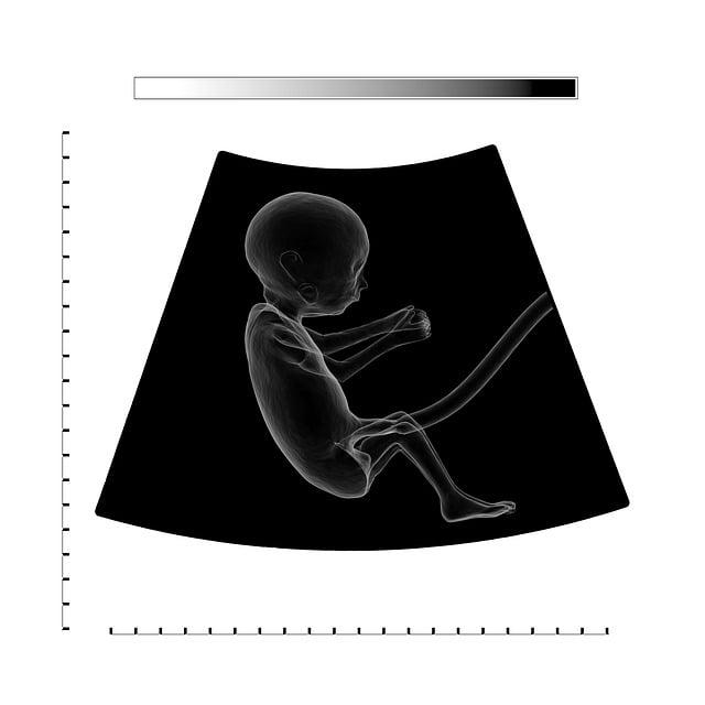 Jak efektivně a zodpovědně nakládat s placentou po porodu